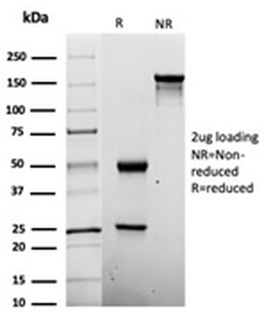 Penicillin Antibody