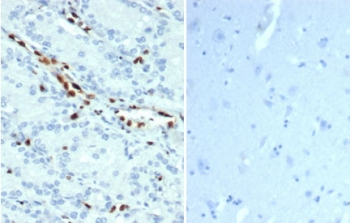 ERG Antibody / Transcriptional regulator ERG