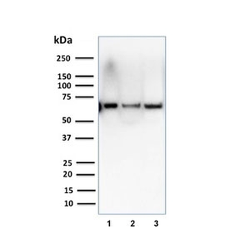 CSTF2T Antibody / Cleavage stimulation factor subunit 2 tau variant
