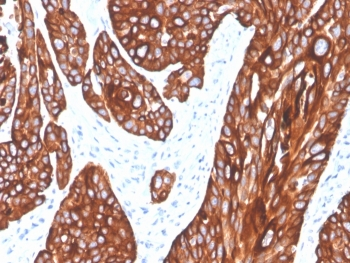 Cytokeratin 5 Antibody / KRT5
