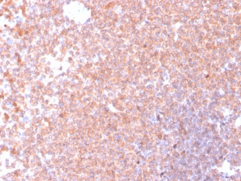 Resistin Antibody / RETN