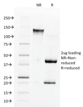 ACE Antibody / Angiotensin I Converting Enzyme