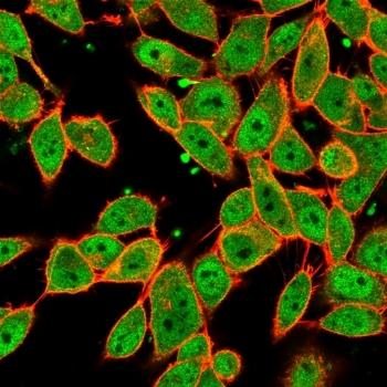 MLX Antibody / Max-like protein X