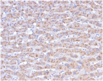 CD40L Antibody / TRAP / CD154
