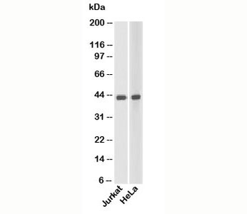 Beta Actin Antibody Loading Control