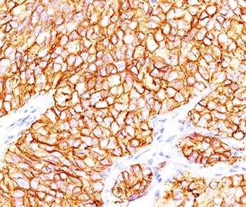 CA9 Antibody / Carbonic Anhydrase IX