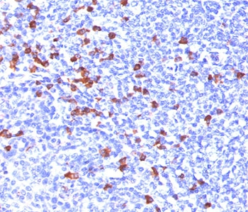 IgG Heavy Chain Antibody