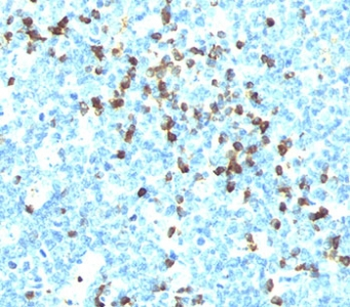 Lambda Light Chain Antibody / Lambda Antibody