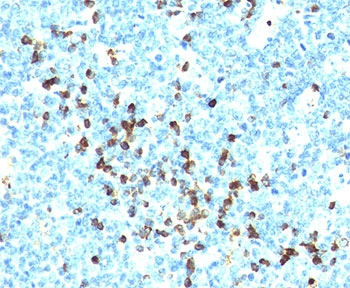 Lambda Light Chain Antibody Cocktail