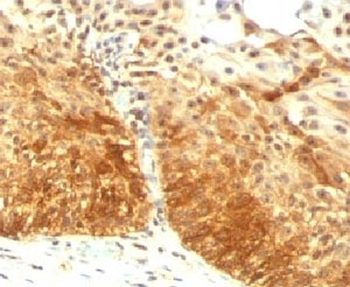 Cytokeratin 14 Antibody / CK14 / KRT14