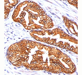 Ornithine Decarboxylase Antibody / ODC1