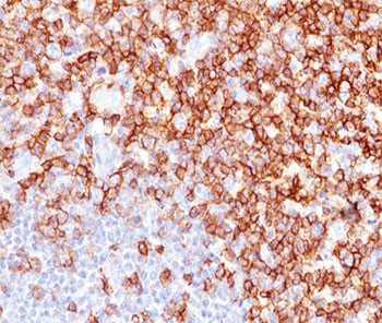 CD45RO Antibody (T-cell marker)