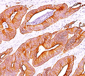 Pan Cytokeratin Antibody Cocktail (Acidic + Basic)