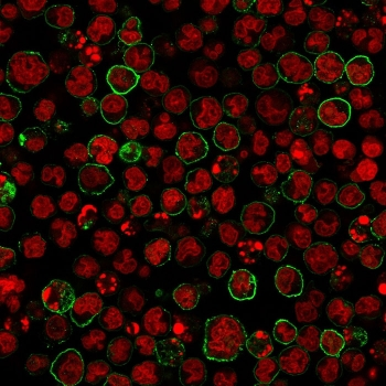CD20 Antibody