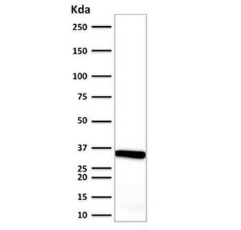 Calponin 1 Antibody