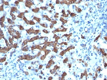 CPS1 Antibody