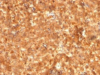 Alpha Fetoprotein / AFP Antibody Cocktail