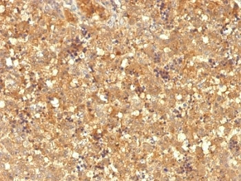 Alpha Fetoprotein / AFP Antibody