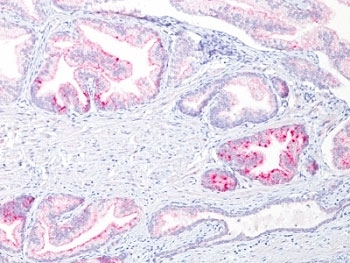 AMACR / p504S Antibody (Prostate Cancer Marker)