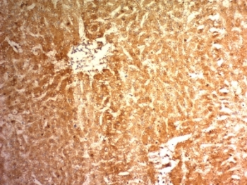 Glypican 3 Antibody / GPC3