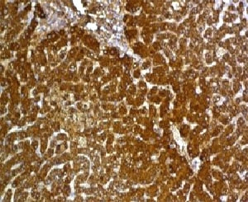 Glypican 3 Antibody / GPC3