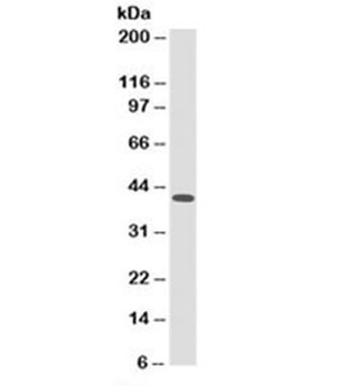 HLA-ABC Antibody (MHC I)