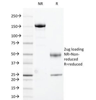 HLA-DR Antibody (MHC II)