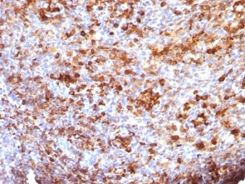 IgG Heavy Chain Antibody