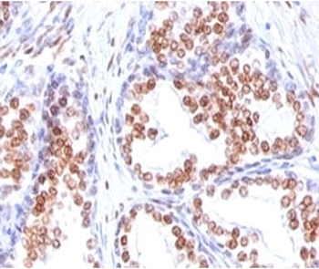 Androgen Receptor Antibody