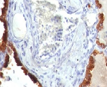KRT7 Antibody / Cytokeratin 7