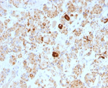 Luteinizing Hormone beta Antibody