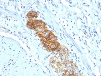 NCAM / CD56 Antibody