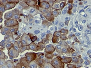 NGF Receptor Antibody / p75NTR / CD271