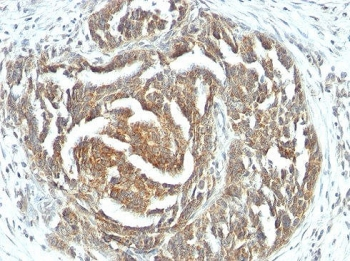 VEGFA Antibody / Vascular Endothelial Growth Factor A