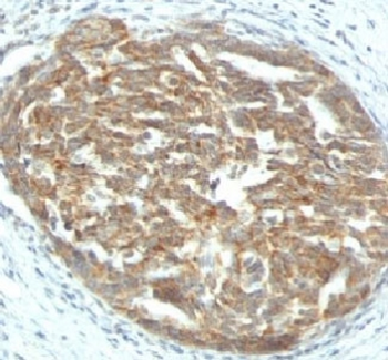 VEGFA Antibody / Vascular Endothelial Growth Factor A
