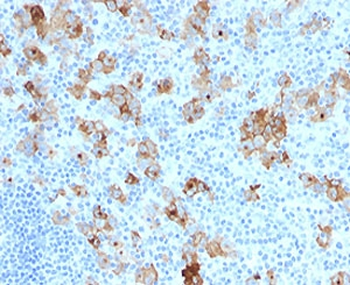 CD30 Antibody