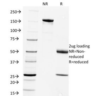 Rabies Virus Antibody