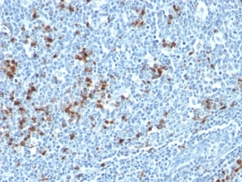 Kappa Light Chain Antibody Cocktail
