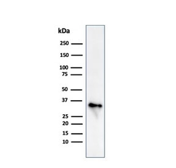 CD74 / CLIP Antibody