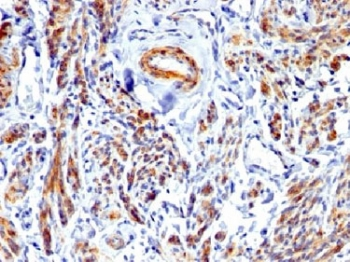 Caldesmon / CAD Antibody HMW
