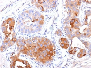 GCDFP-15 Antibody / PIP / Prolactin-Induced Protein