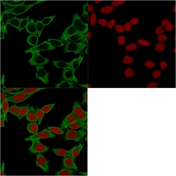 SPTBN2 Antibody / Spectrin beta III