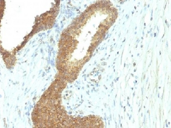 Tissue-nonspecific Alkaline Phosphatase Antibody / ALPL