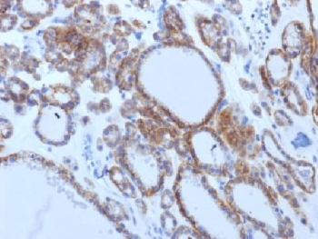 Thyroid Stimulating Hormone Receptor / TSHR Antibody (beta chain)