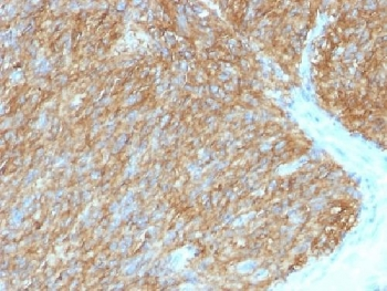 DOG1 Antibody / TMEM16A / ANO1