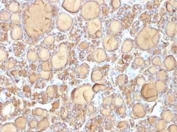 TG Antibody / Thyroglobulin