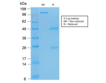 p53 Antibody / TP53 N-Terminal Region