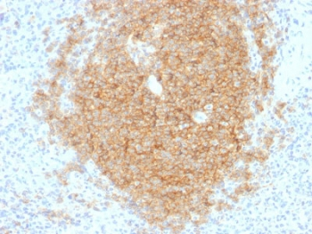 CD40 Antibody