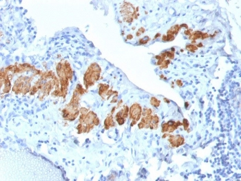 SMMHC Antibody (Smooth Muscle Myosin Heavy Chain)