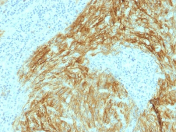 CD21 Antibody